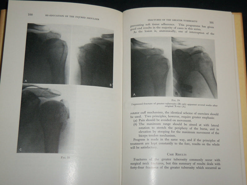 1959 RE-EDUCATION OF THE INJURED SHOULDER HARDCOVER BOOK BY BROOKES- KD 7203