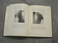 1921 INJURIES & DISEASES OF THE BONES AND JOINTS BY BAETJER & WATERS - KD 2759C
