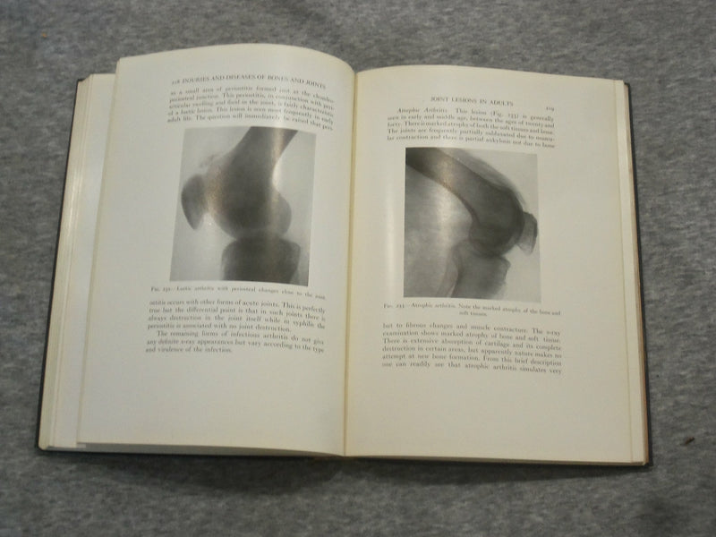 1921 INJURIES & DISEASES OF THE BONES AND JOINTS BY BAETJER & WATERS - KD 2759C