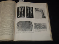 1916 JOHNS HOPKINS HOSPITAL BULLETIN BOUND VOLUME NO. 27 - KD 5403K