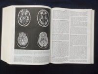 1987 HARRISON'S PRINCIPLES OF INTERNAL MEDICINE HARDCOVER BOOK - FAUCI - KD 8893