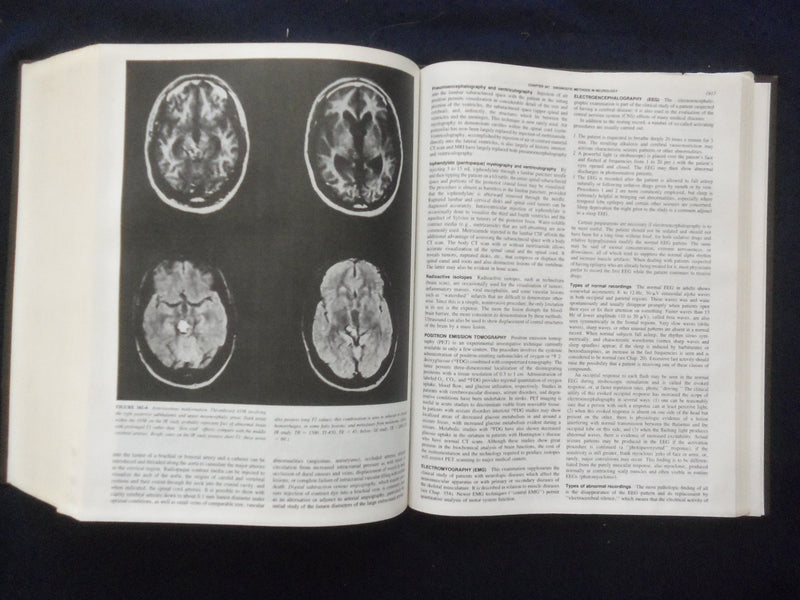 1987 HARRISON'S PRINCIPLES OF INTERNAL MEDICINE HARDCOVER BOOK - FAUCI - KD 8893