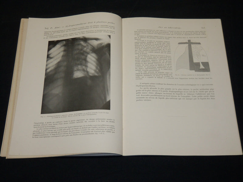 1916-1917 JOURNAL DE RADIOLOGIE ET ELECTROLOGIE MAGAZINE LOT OF 6 - O 1410T