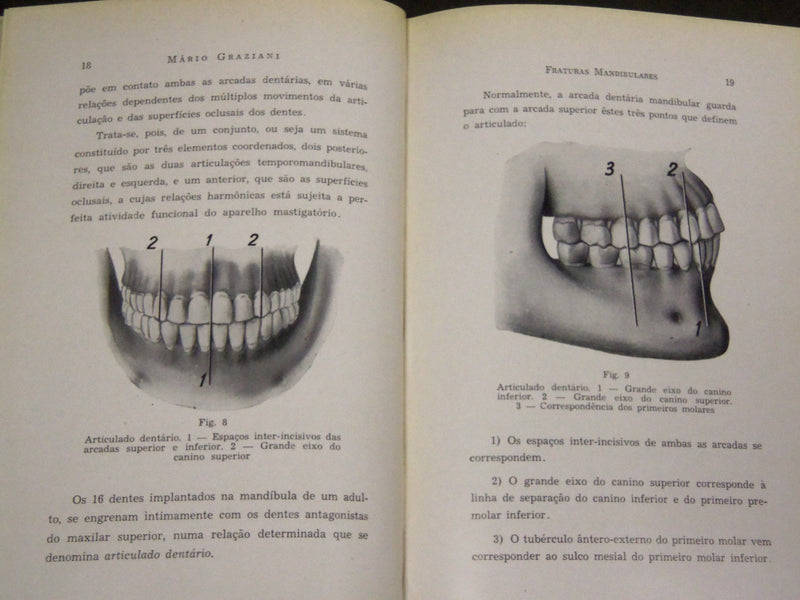 1944 FRATURAS MANDIBULARES AUTHOR INSCRIBED BY DR. MARIO GRAZIANI - KD 2619