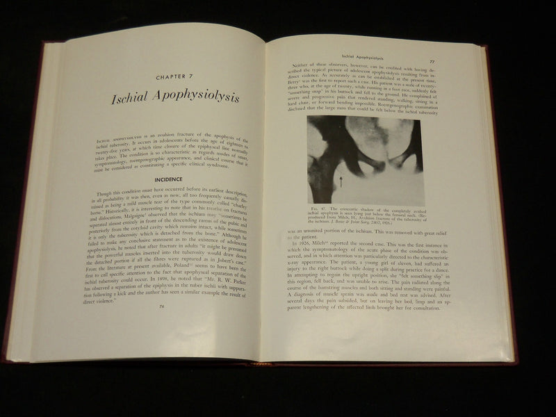 1958 INJURIES AND SURGICAL DISEASES OF THE ISCHIUM BOOK HENRY MILCH - KD 2768L