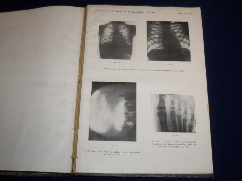 1921-1922 FORTSCHRITLE AUF DEMGEBIETE DER RONTGENSTRAHLEN VOLUME - KD 2951P