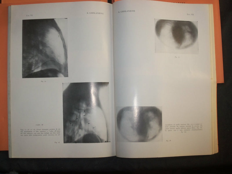 1933-1956 ARCHIVIO DI RADIOLOGIA LOT OF 86 ISSUES - ITALIAN TEXT - WR 452