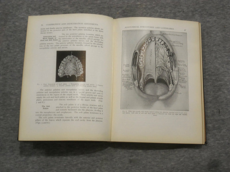 1923 CONDUCTION AND INFILTRATION ANESTHESIA BY MENDEL NEVIN - KD 2758Q
