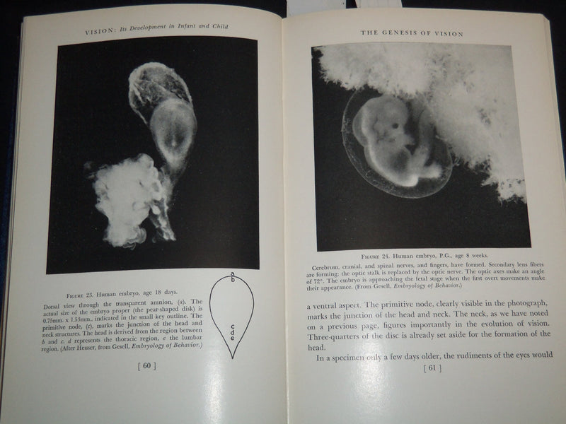 1949 VISION ITS DEVELOPMENT IN INFANT AND CHILD BOOK BY ARNOLD GESELL - KD 5980U