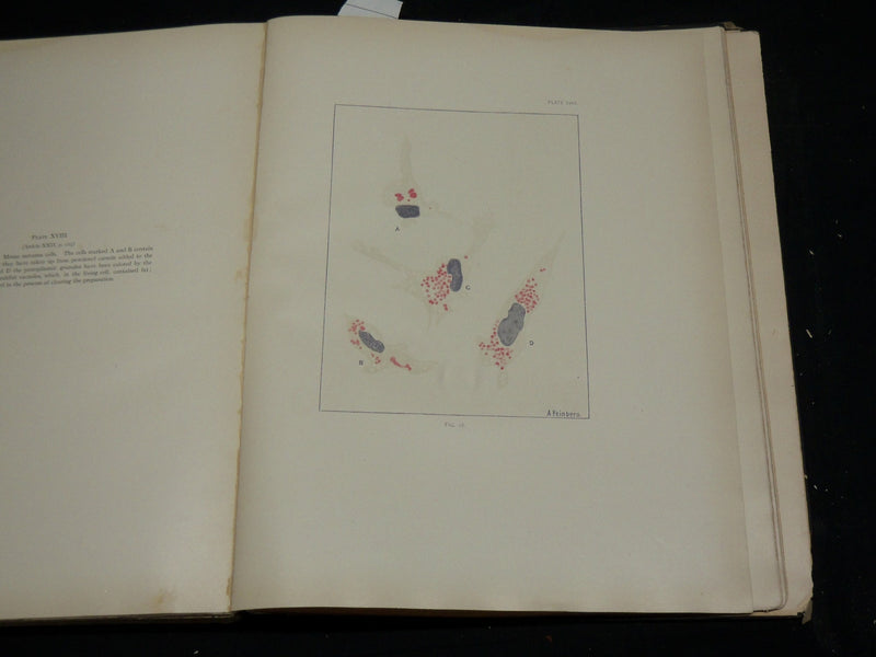 1912 STUDIES IN CANCER - PATHOLOGY BOUND VOLUME NO. 2 - 32 PLATES - KD 4500
