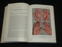 1947 PERIPHERAL VASCULAR DISEASES BOOK BY EDGAR N. ALLEN M. D. - KD 2766A