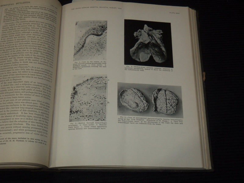 1916 JOHNS HOPKINS HOSPITAL BULLETIN BOUND VOLUME NO. 27 - KD 5403K