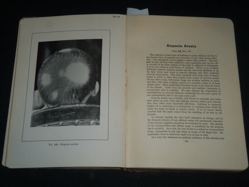 1913 PORTFOLIO OF DERMOCHROMES BY JEROME KINGSBURY VOLUMES 1-3 - KD 986
