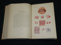 1894-1904 ARCHIV FUR LARYNGOLOGIE UND RHINOLOGIE GERMAN VOLUMES LOT OF 13 - KD 9