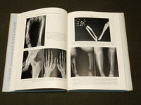 1962 EXAMINATION AND DIAGNOSIS OF THE SPINE & EXTREMITIES BY HOWORTH MD- KD 6276