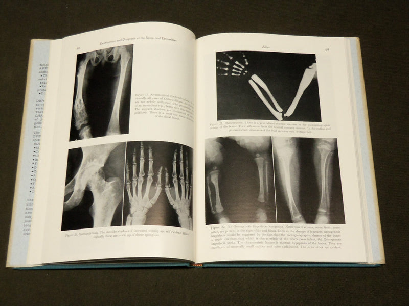 1962 EXAMINATION AND DIAGNOSIS OF THE SPINE & EXTREMITIES BY HOWORTH MD- KD 6276