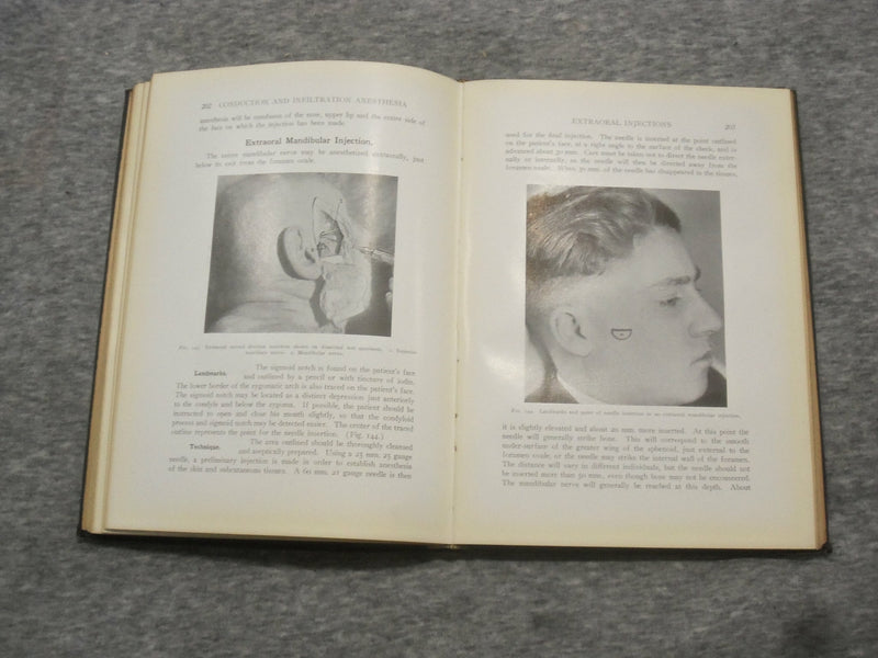 1923 CONDUCTION AND INFILTRATION ANESTHESIA BY MENDEL NEVIN - KD 2758Q