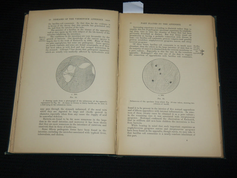 1895 ON DISEASES OF THE VERMIFORM APPENDIX HARDCOVER BOOK BY HAWKINS - KD 7359