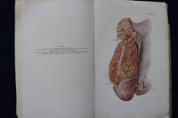 1934 BRUCELLA INFECTION IN SWINE SOFTCOVER BOOK BY AXEL THOMSEN -SIGNED - K 1462