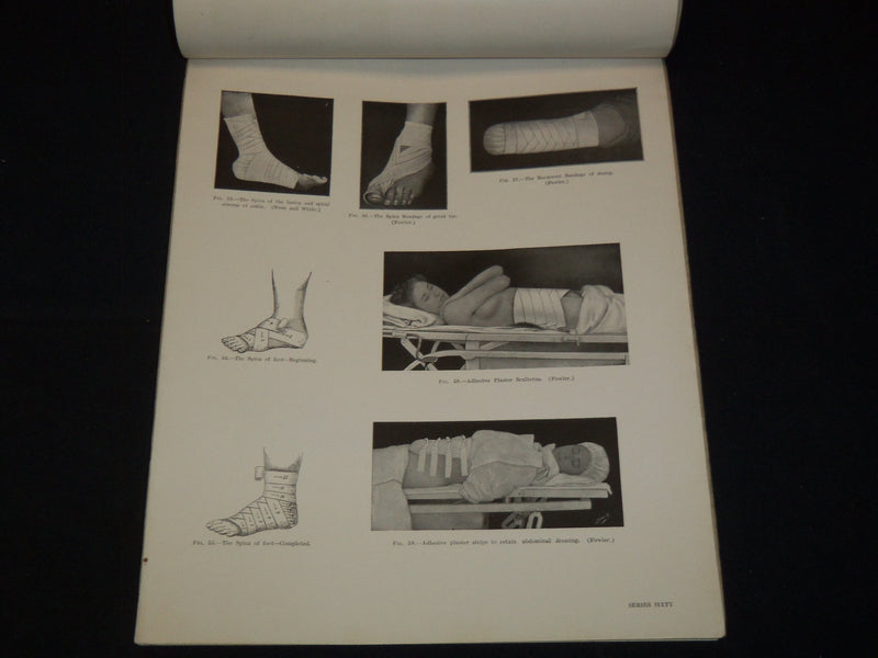 1915 MODERN SURGICAL NURSING BY EUGENE UNDERHILL, M. D. - 9 PARTS - O 3638D