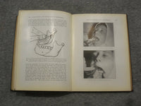 1923 CONDUCTION AND INFILTRATION ANESTHESIA BY MENDEL NEVIN - KD 2758Q