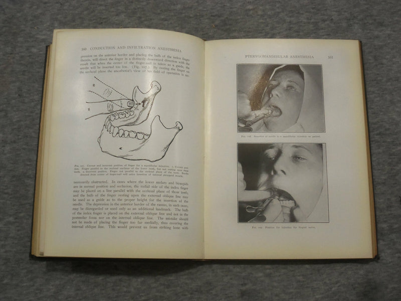 1923 CONDUCTION AND INFILTRATION ANESTHESIA BY MENDEL NEVIN - KD 2758Q