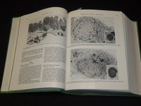 1982-1988 CANCER JOURNAL MAGAZINE BOUND VOLUMES LOT OF 6 - KD 1I