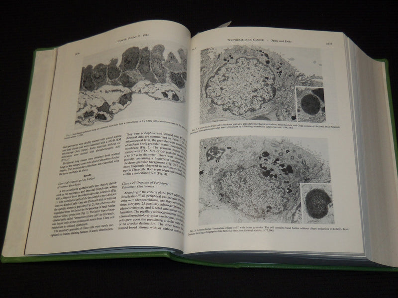1982-1988 CANCER JOURNAL MAGAZINE BOUND VOLUMES LOT OF 6 - KD 1I