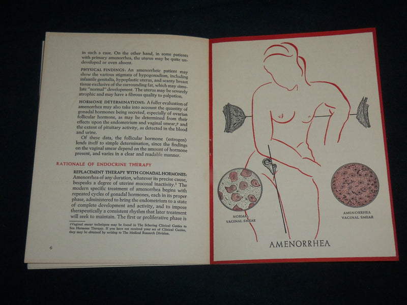 1943 AMENORRHEA ITS ENDOCRINE SOFTCOVER BOOK - BLOOMFIELD NEW JERSEY - J 6799