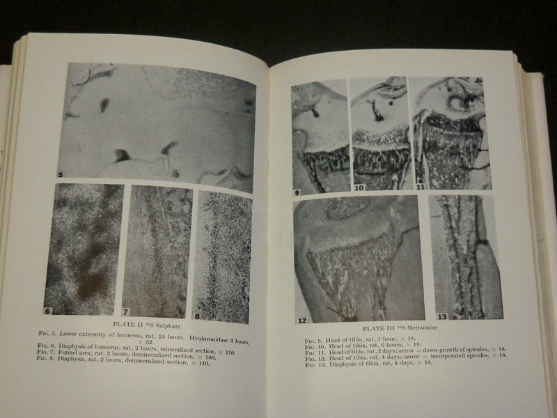 1956 BONE STRUCTURE AND METABOLISM BOOK - CIBA SYMPOSIUM - KD 6163