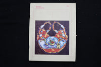 1975 RESEARCH ADVANCES MAGAZINE - AXIAL TOMOGRAPHY OF SKULL COVER - E 11143