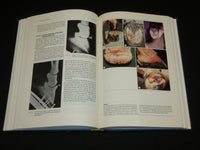 1986 EQUINE DISEASES HARDCOVER BOOK BY HANNS-JURGEN WINTZER - KD 7411