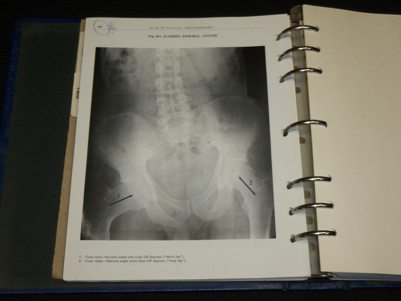 1975 ATLAS OF CLINICAL ROENTGENOLOGY HARDCOVER BOOK BY EARL A. RICH - R 722P