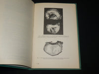 1946 THE INTERVERTEBRAL DISCS HARDCOVER BOOK BY ORMOND A. BEADLE - KD 6457