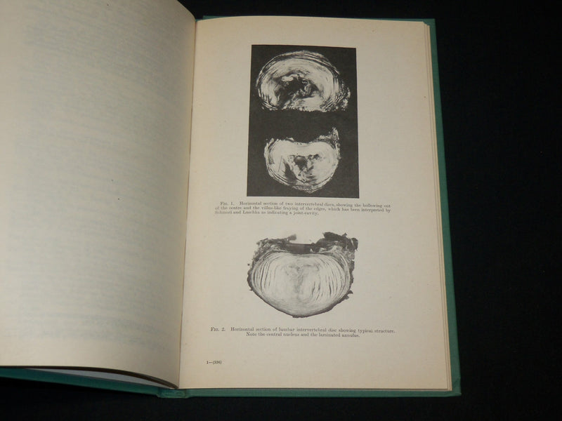 1946 THE INTERVERTEBRAL DISCS HARDCOVER BOOK BY ORMOND A. BEADLE - KD 6457