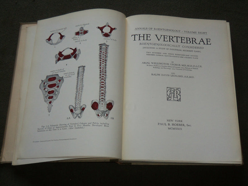 1929 ANNALS OF ROENTGENOLOGY VOLUME 8 - JAMES CASE - THE VERTEBRAE - KD 6218