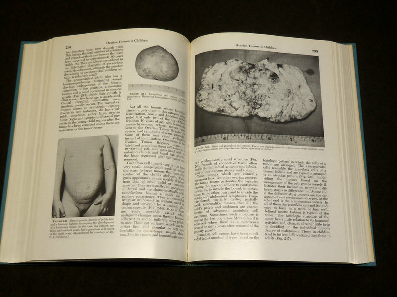1969 THE GYNECOLOGY OF CHILDHOOD AND ADOLESCENCE BOOK BY HUFFMANN - KD 6137