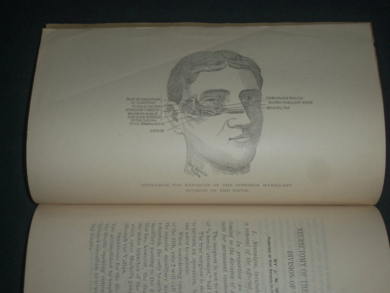 1800'S A CASE OF NEURECTOMY BOOK - SUPERIOR MAXILLARY OPERATION - J 3942