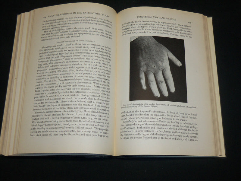 1944 RESPONSES IN EXTREMITIES OF MAN BOOK BY DAVID I. ABRAMSON, M. D. - KD 2764Y