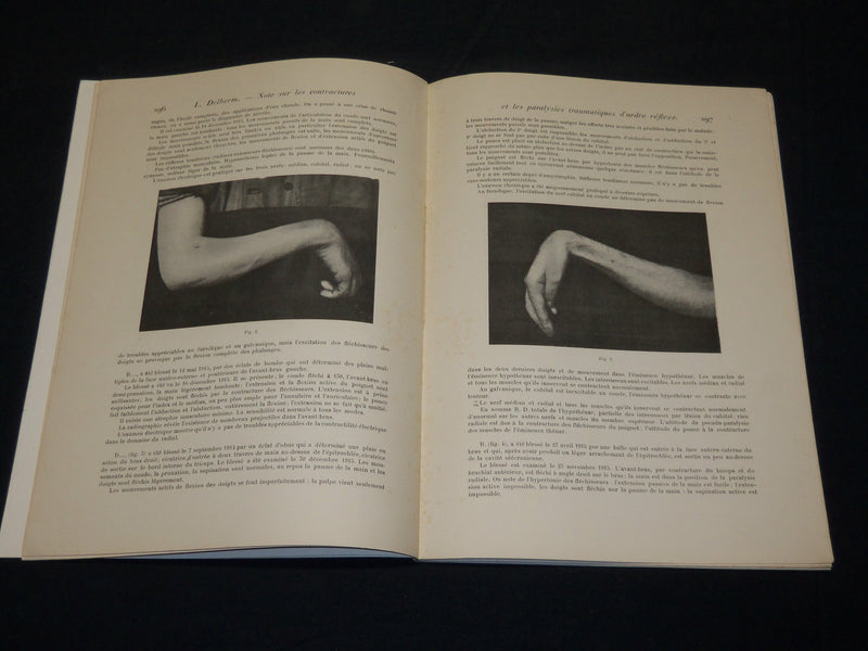 1916-1917 JOURNAL DE RADIOLOGIE ET ELECTROLOGIE MAGAZINE LOT OF 6 - O 1410T