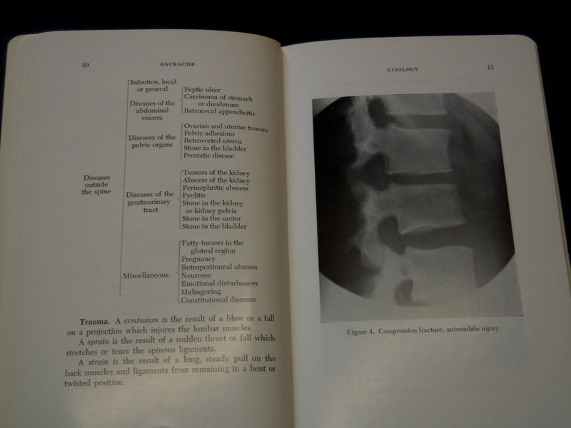 1955 BACKACHE SOFTCOVER BOOK BY FRANK R. OBER MD - KD 7664