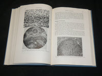 1961 THE CERVIX UTERI AND ITS DISEASES BOOK BY FREDERIC FLUHMANN M. D.- KD 2761C