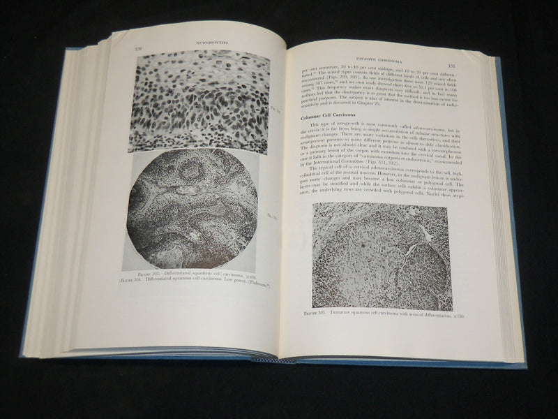 1961 THE CERVIX UTERI AND ITS DISEASES BOOK BY FREDERIC FLUHMANN M. D.- KD 2761C