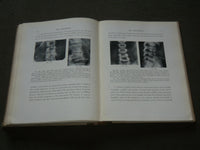 1929 ANNALS OF ROENTGENOLOGY VOLUME 8 - JAMES CASE - THE VERTEBRAE - KD 6218