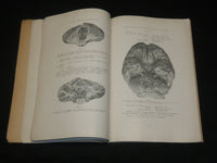 1927-1935 ARCHIVES ARGENTINOS DE NEUROLOGIA SPANISH MAGAZINES LOT OF 5 - WR 505E