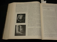 1910 JAN-JUN BERLINER KLINISCHE WOCHENSCHRIFT MAGAZINE BOUND VOLUME - KD 3644C