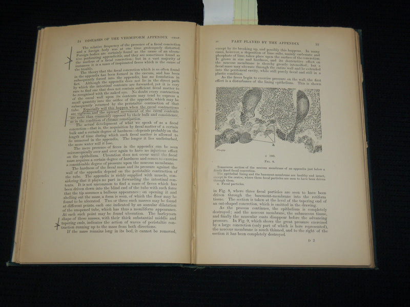1895 ON DISEASES OF THE VERMIFORM APPENDIX HARDCOVER BOOK BY HAWKINS - KD 7359