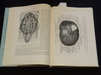 1957 RETRO PNEUMOPERITONEUM UND PPNEUMOMEDIASTINUM VON UMBERTO COCCHI - KD 5981J