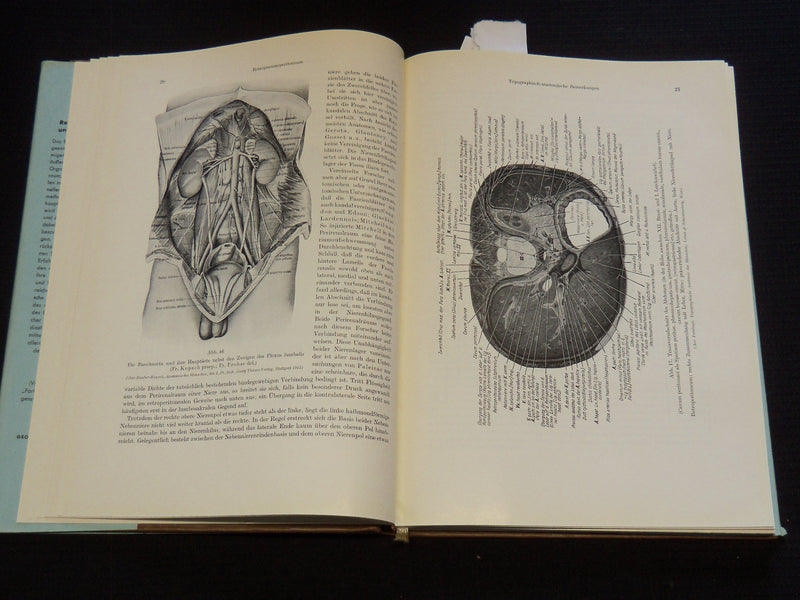 1957 RETRO PNEUMOPERITONEUM UND PPNEUMOMEDIASTINUM VON UMBERTO COCCHI - KD 5981J