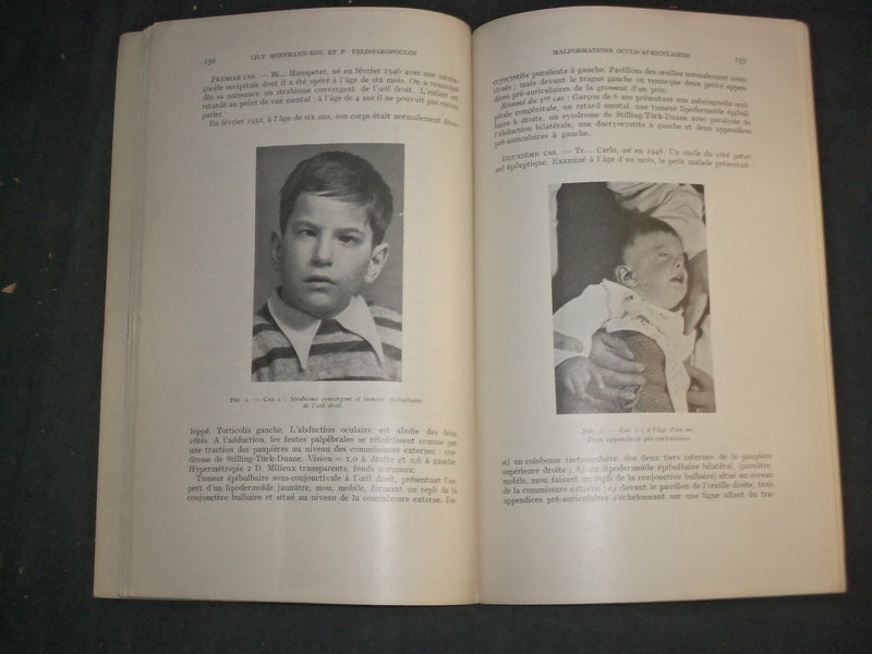 1951-1957 ANNALES D'OCULISTIQUE-LOT OF 63- NICE ARTICLES & PHOTOS-FRENCH-WR 790C